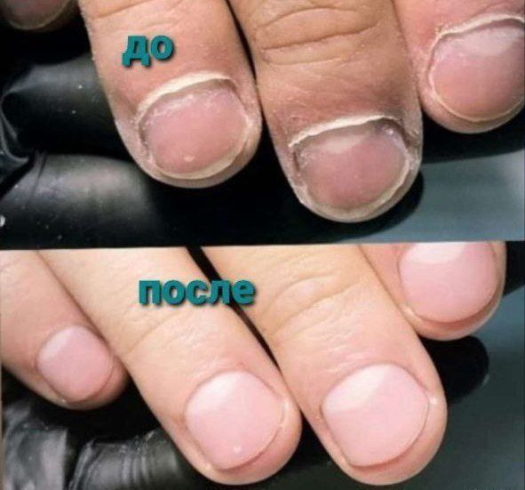 Мужской эстетический маникюр и педикюр куйлюк