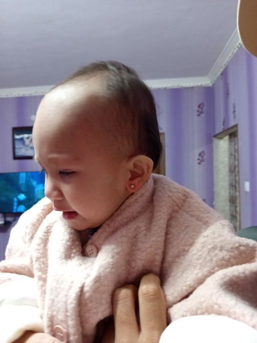 Umuman Og'ritmasdan quloq burun teshaman