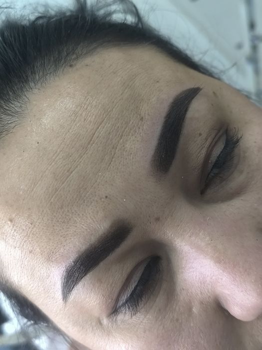 Косметолог лазеролог со стажем 10лет