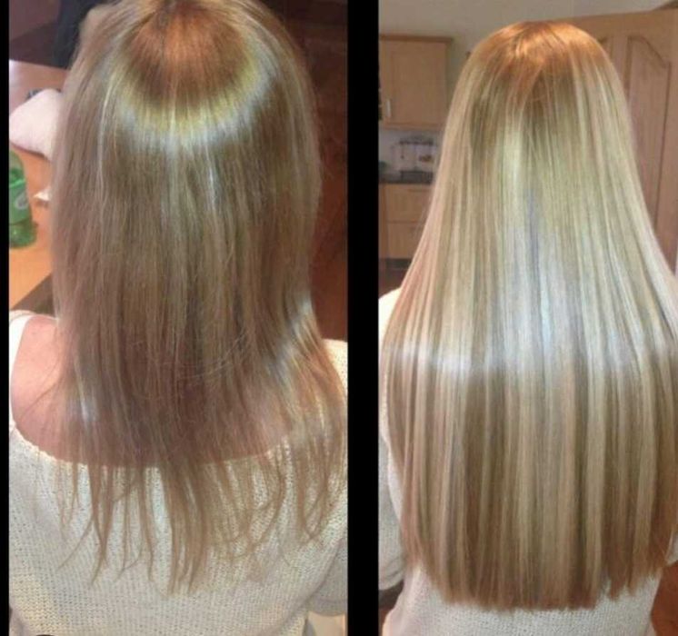 Aplic extensii tape on