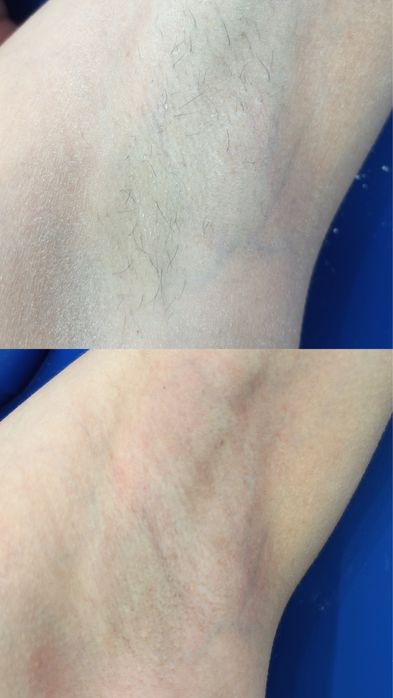 Шугаринг в домашней студии