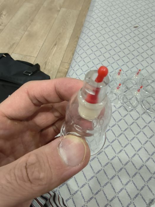 Банки для хиджамы б/у