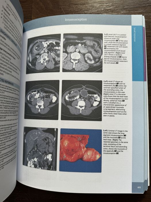 Diagnostic Imaging Gastrointestinal 2015