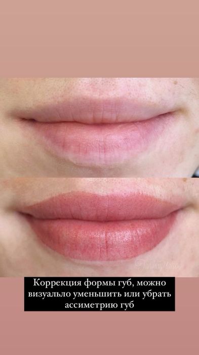 Удаление татуажа. Перманент. Юг