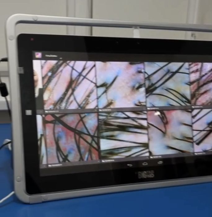 Аппарат для диагностики волос и лица