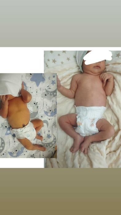 Fotolampa - chaqaloq uchun xavfsiz yorug'lik terapiyasi,Фотолампа куез