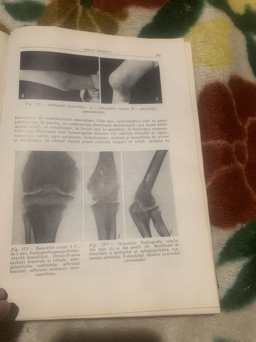 Tratat PEDIATRIE 1960- vol 2 - Editura Medicala
