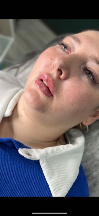 Нужны модели на увеличение губ