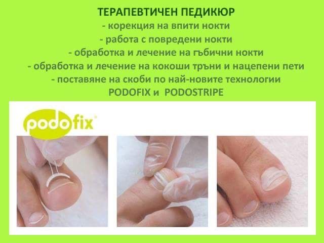 Терапевтичен педикюр град Русе