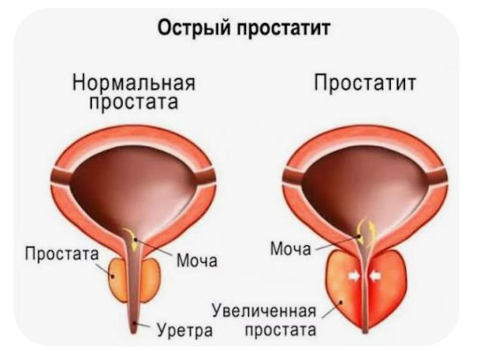 Простата массажын жасаймын
