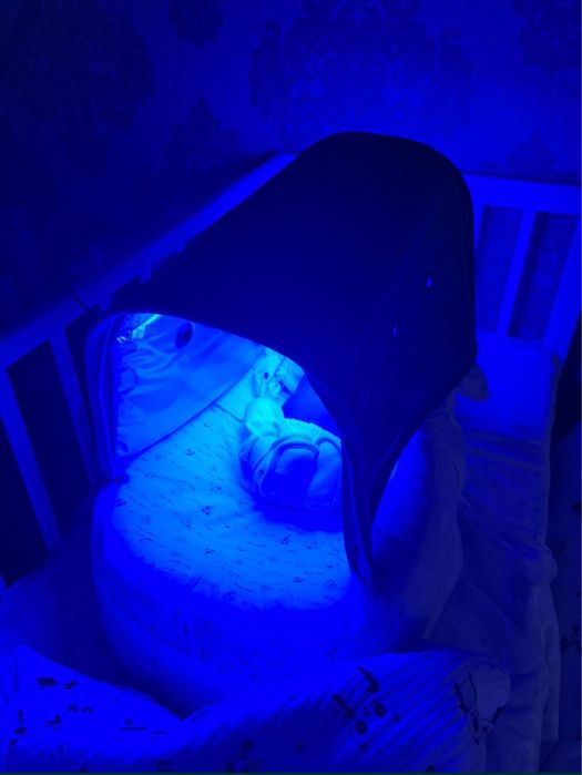 эффективная 100%/фотолампа от желтухи/желтушки/кювез/аренда