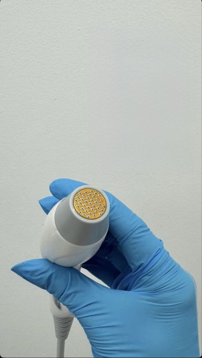 Aparat Tratamente Faciale (FaceSpa)