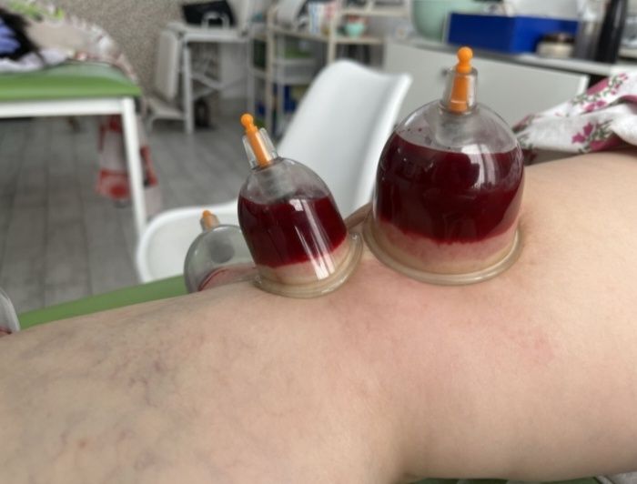 Хиджама г. Актау