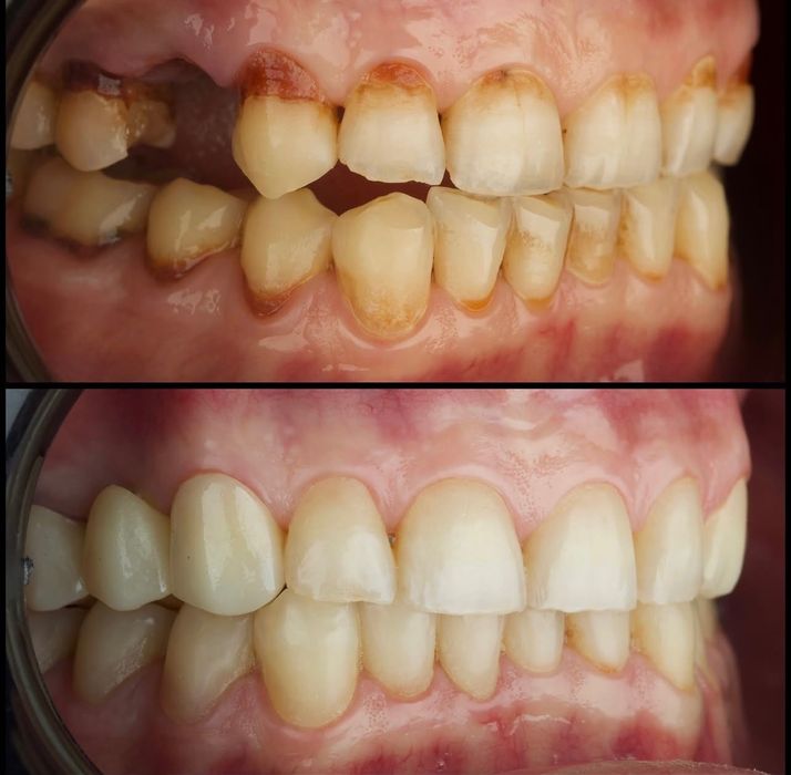 Canon 650D Sigma 105mm SoftBox Godox 400sk