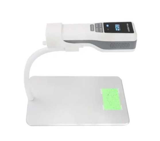 Venovizer – Vena topuvchi tibbiy qurilma | веновизор | Vein Finder