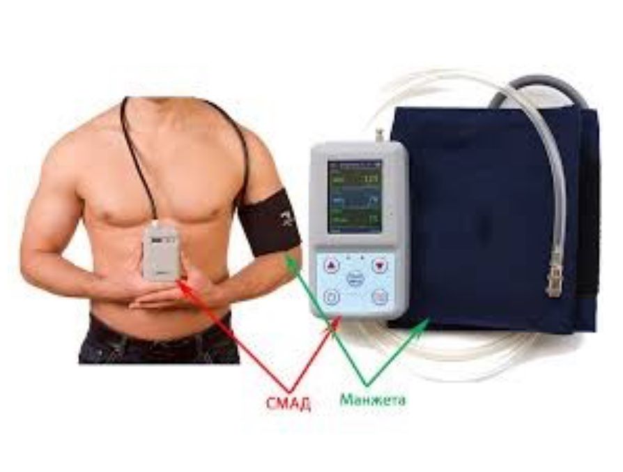 АД Монитор СМАРТ Суточное мониторования артериального давления