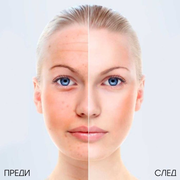 Ултразвуков масажор за лице - TV224