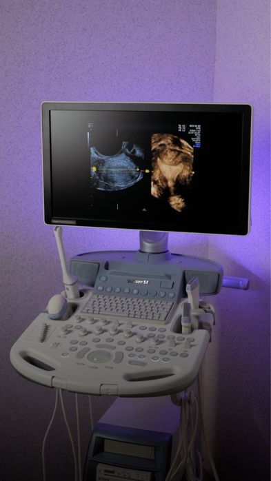 Voluson S8 BT16 узи экспертного класса