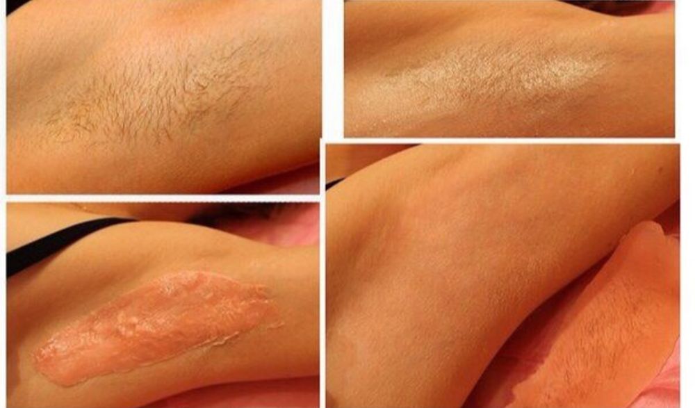 Шугаринг(восковая депиляция ) в центре города