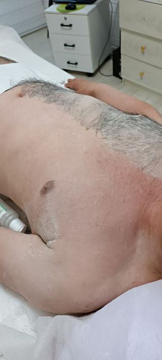 Депиляция мужчинам