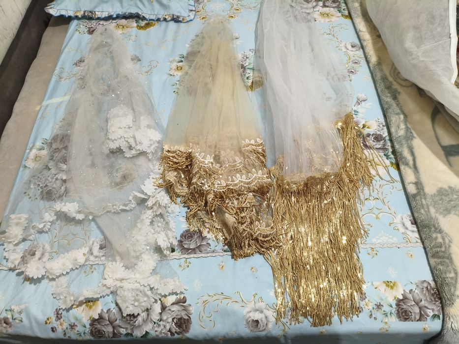 Sari kanplek karona anorli sirga uzuk boʻyniga taqadigani bn holat yax