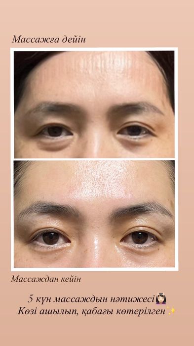 Миофасциальный массаж лица Астана