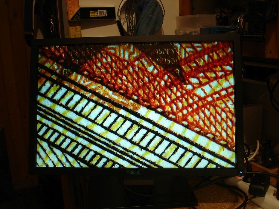 Trichineloscop digital