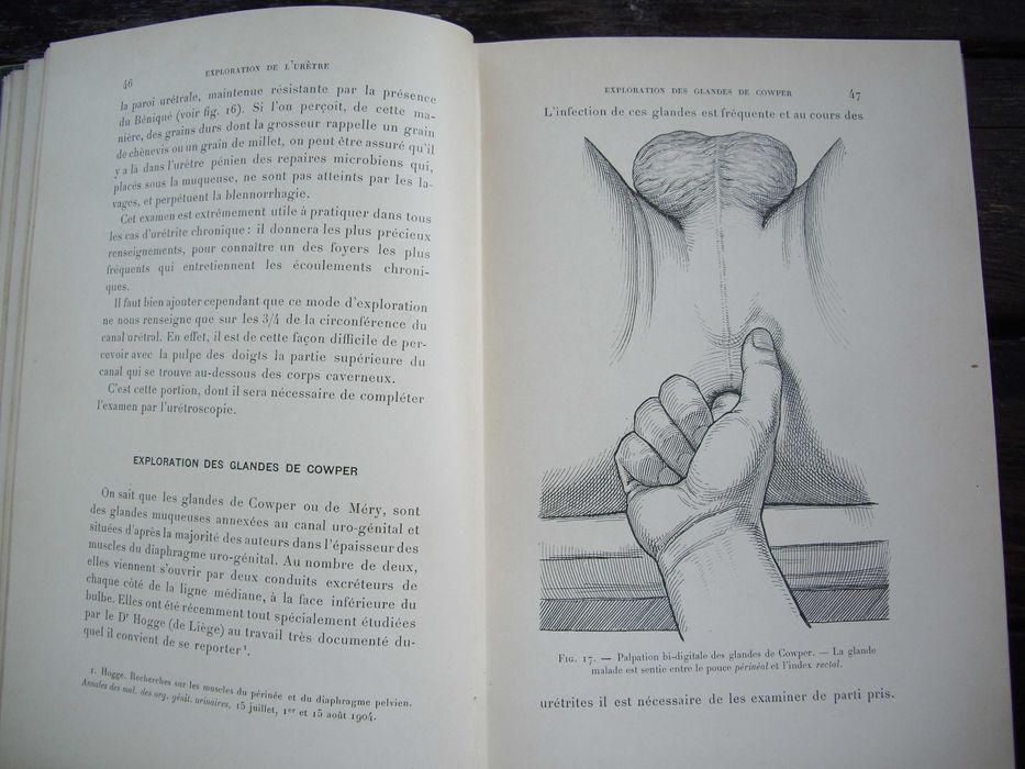 Медицинска книга Изследване на уринарната система, 1909 , френска