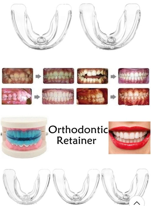 Промо-Ортодонтски коректор,шини,алайнер на зъби брекети зъбен фиксатор