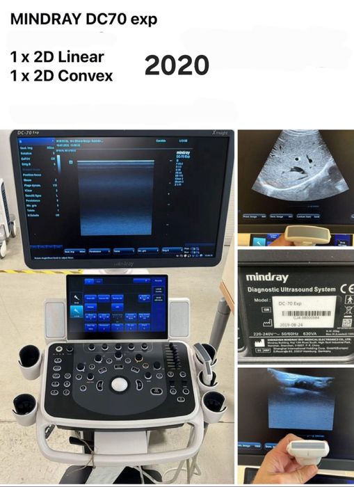 Mindray DC-70 X-Insight УЗИ аппарат