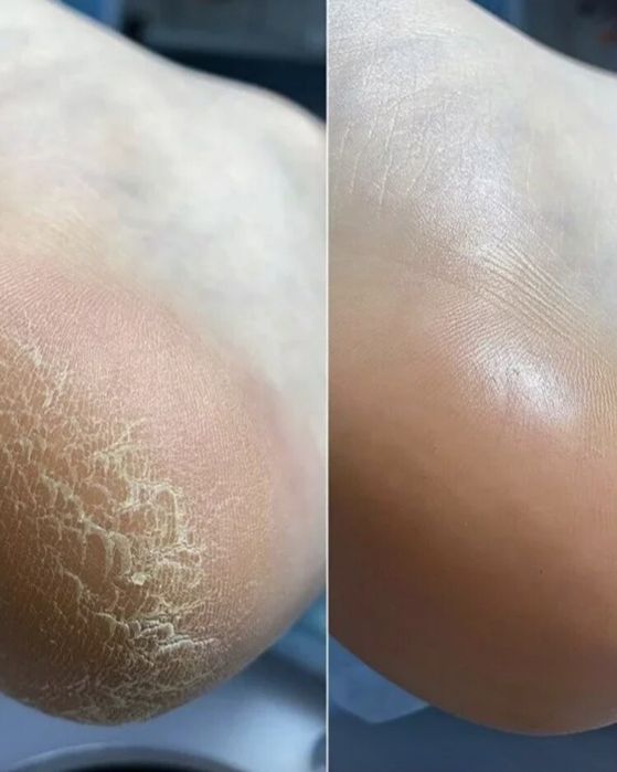 Маникюр педикюр Сарань.