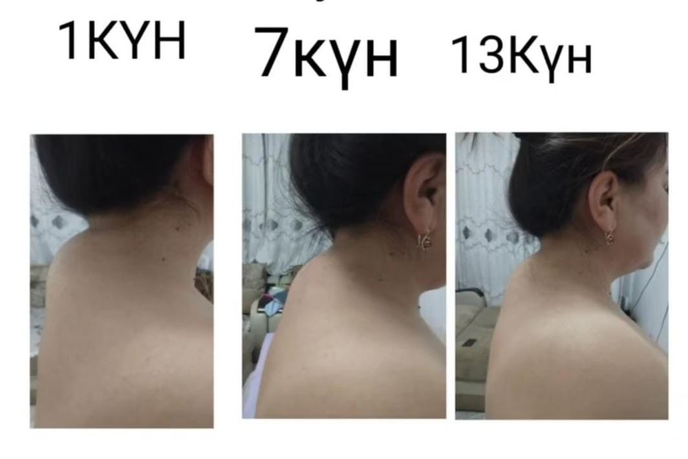 Емдік сауықтыру массажы