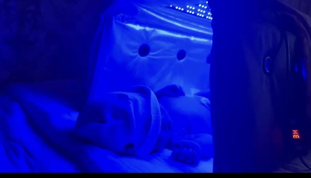 Фотолампа от желтухи