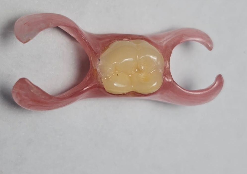 Все виды зубной протезы ,каппы элайнеры