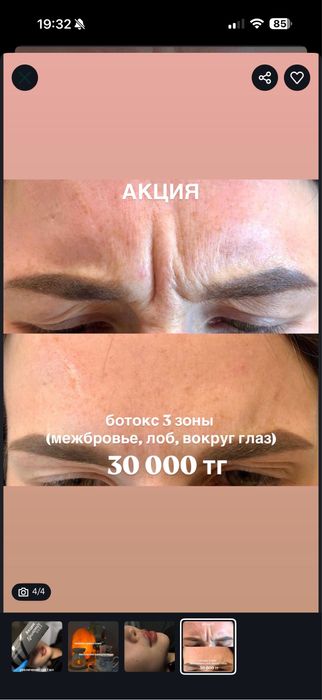 Акция губы, ботокс, чистка, плазма