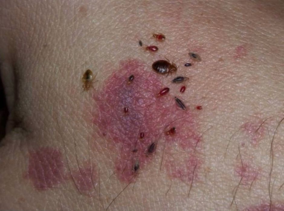 Дезинфекция хизмати 24/7 навоий