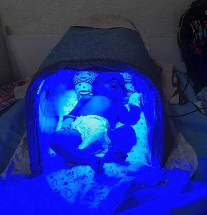 Фотолампа,Продаю Фотолампа от желтухи у детей Есть доставка по городу.