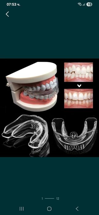 Ортодонтски коректор,шини,алайнер на зъби брекети зъбен фиксатор
Невид