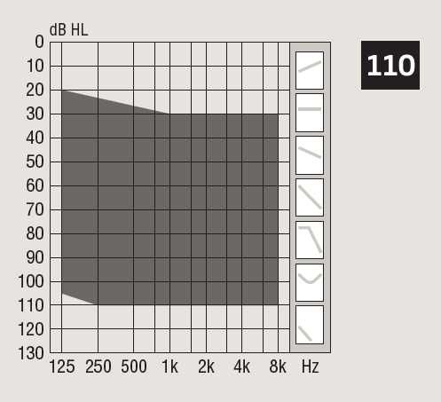Детские Слуховой Аппарат Bolalar quloq aparati XCEED 3 SP / UP