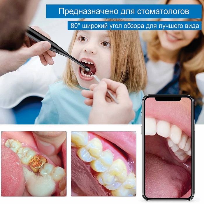Эндоскоп. Интраоральная камера. Стоматологам. Стоматологлаучун