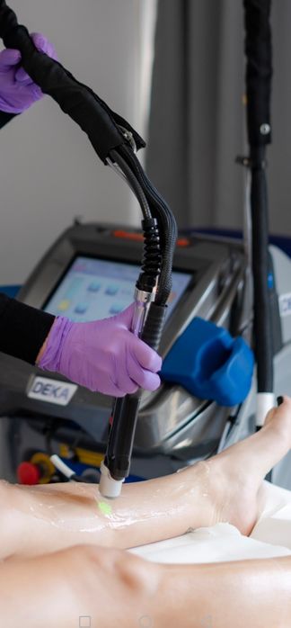 Deka Motus Ax - Laser epilare definitivă Alexandrite