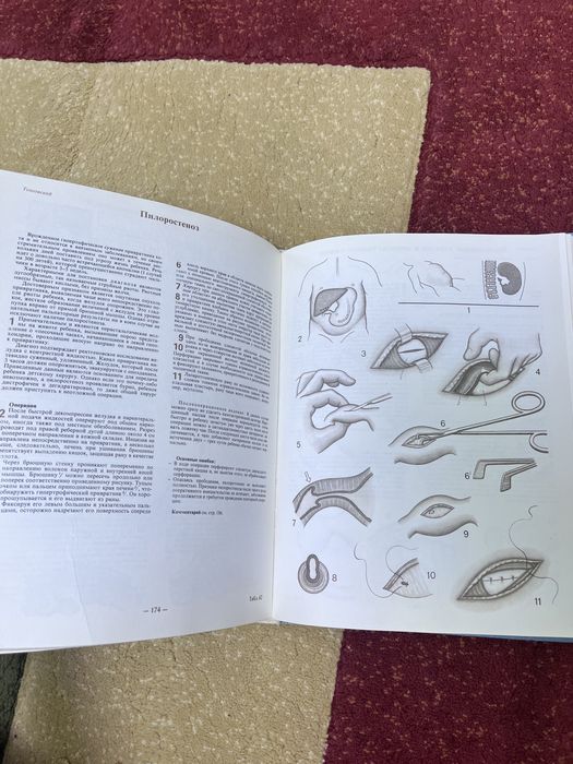 Продам книгу по хирургии