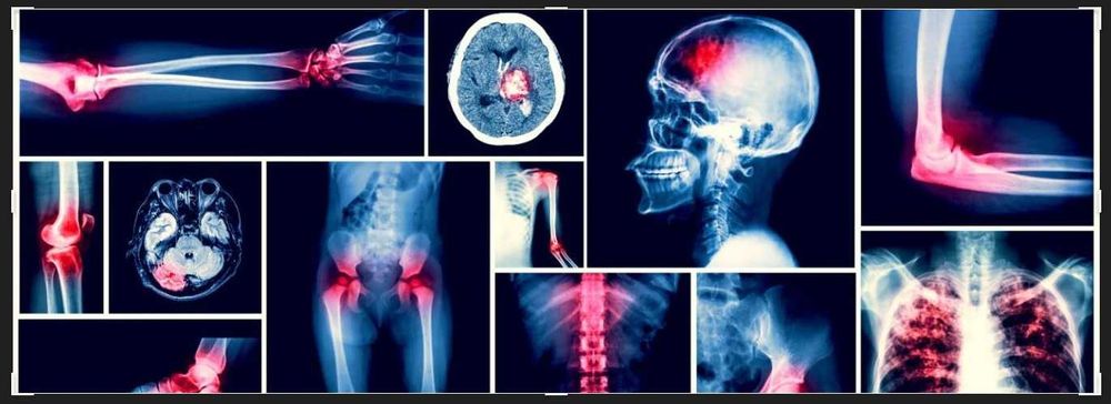 ВТОРО МНЕНИЕ ЗА КОМПЮТЪРНА ТОМОГРАФИЯ РЕНТГЕН СКЕНЕР ЯДРЕНО-МАГНИТЕН РЕЗОНАНС МАМОГРАФ.Разчитане на Образни Изследвания-КТ CT ЯМР MR Рентгенова снимка