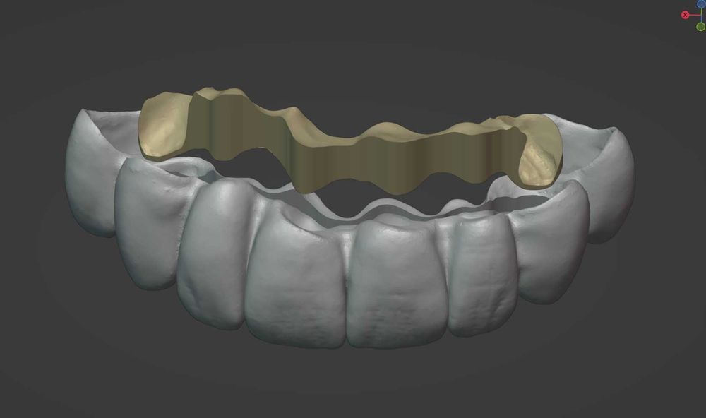 CAD/CAM дизайн |Корони, мостове, барове| 3Shape | Blender for Dental |