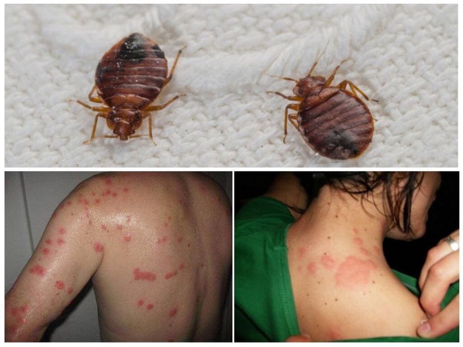 20% Скидка Дезенфекция дизенфекция дезинфекция дизинфекцияdizinfeksiya