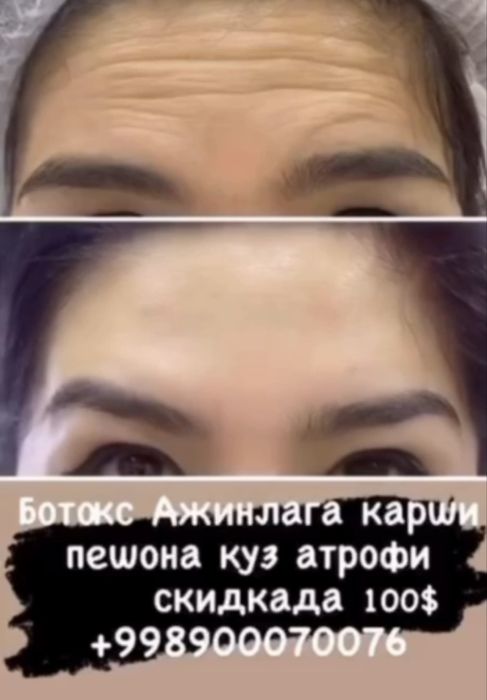 Лазер | Ботокс | Пилинги | Удаление татуажа | Косметолог