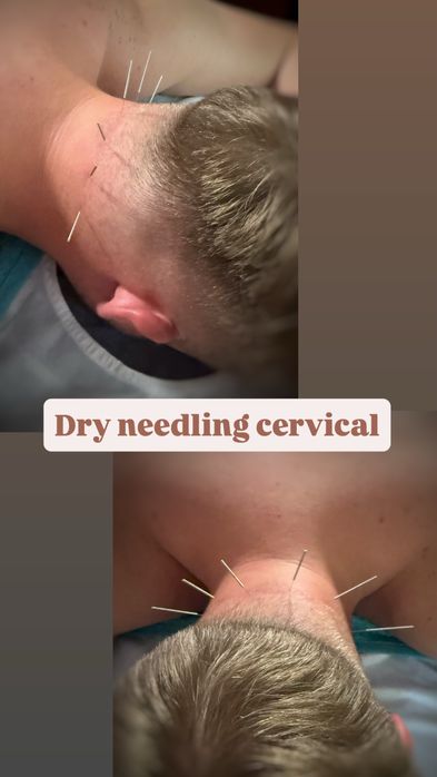 Masaj/kinetoterapie/chiropractica/acupunctura/recuperare