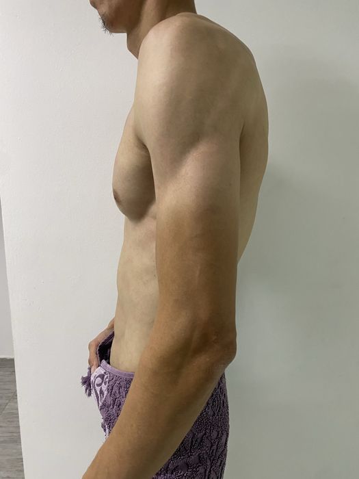 Мануальная терапия !