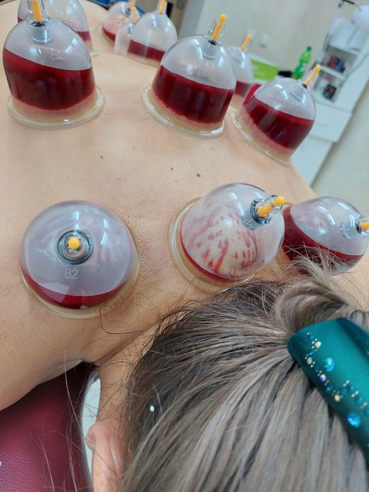 Хиджама Шымкент!!!