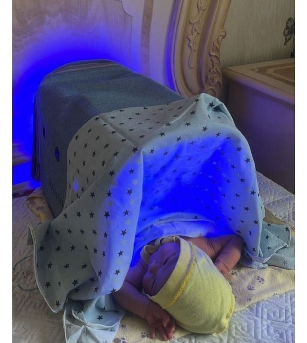 Кювез фотолампа от желтухи